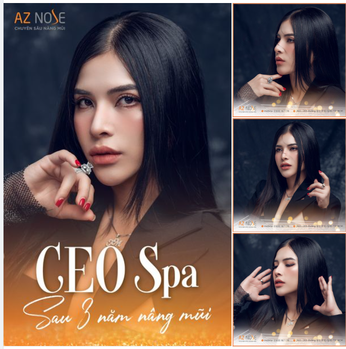 CEO Spa sau 3 năm nâng mũi Độc lập, xinh đẹp và hạnh phúc!