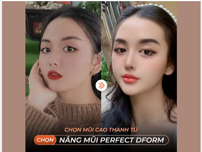 CHỌN MŨI CAO THANH TÚ - CHỌN NÂNG MŨI PERFECT DFORM