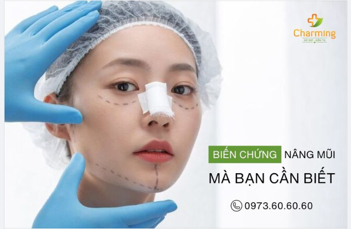 NHỮNG BIẾN CHỨNG THƯỜNG GẶP KHI PHẪU THUẬT NÂNG MŨI CẤU TRÚC