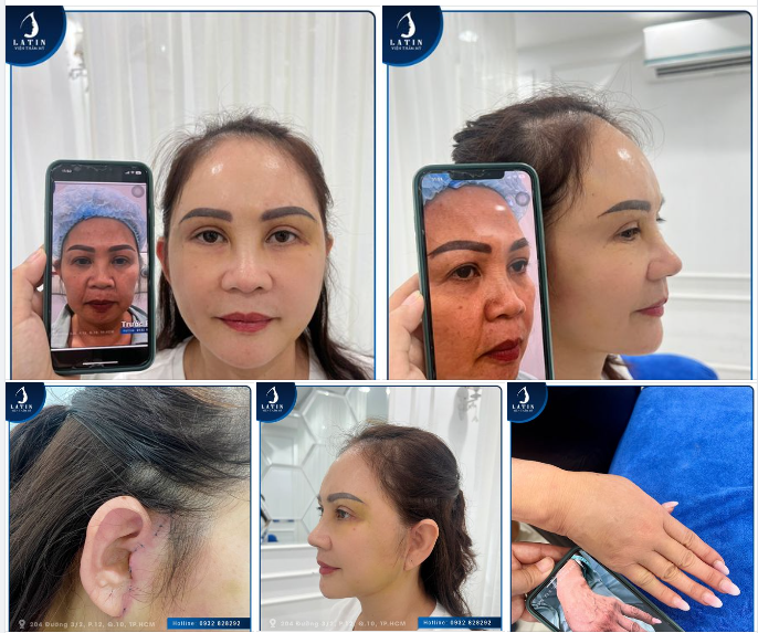 THAY ĐỔI DIỆN MẠO - TRẺ HÓA NHAN SẮC