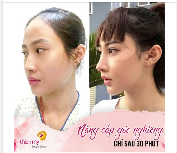 Mũi cao, mặt xinh như thế này không "làm" hơi phí ạ!