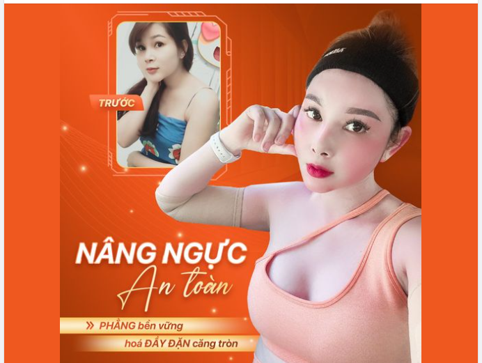 PHẲNG BỀN VỮNG HOÁ ĐẦY ĐẶN CĂNG TRÒN