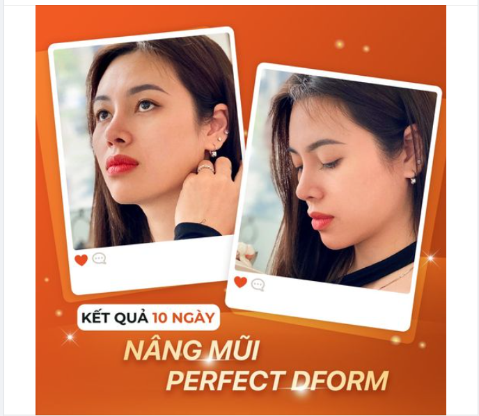 10 điểm chất lượng cho dáng mũi 10 ngày tuổi. Mũi xinh - tự tin lên hình.
