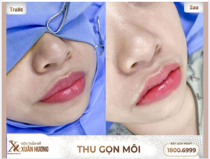 Dáng môi ảnh hưởng nhan sắc như thế nào?