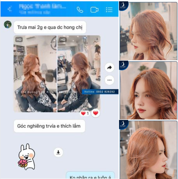 Mũi Cấu trúc SURGIFORM Tròn 1 Tháng 10 Ngày!