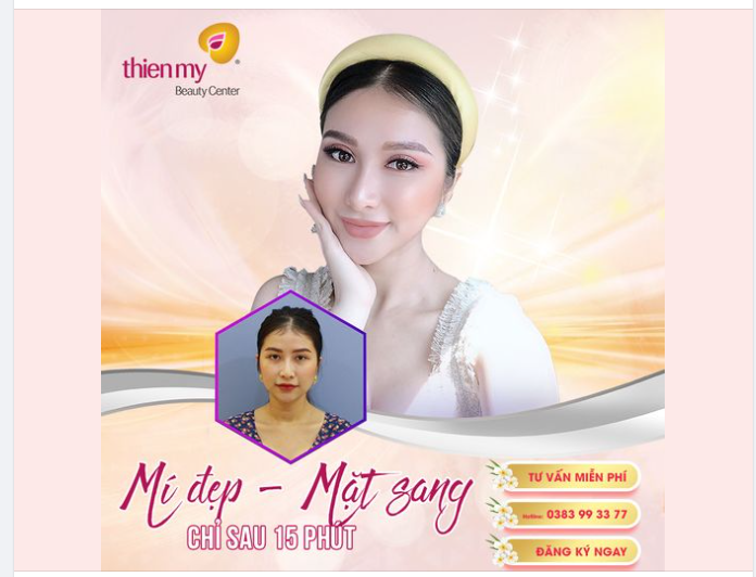 OMG! Kết quả cắt mí 2 tháng quá xuất sắc!