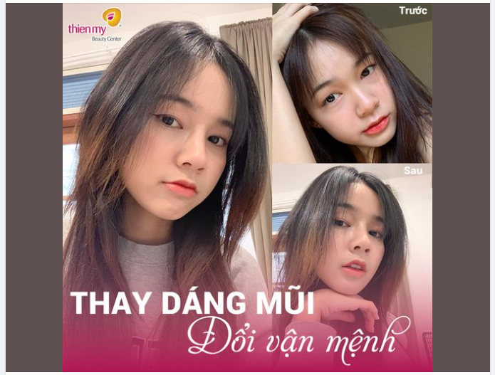 Chuyện tâm linh, không đùa được! Nâng mũi xong làm việc gì cũng thuận lợi!