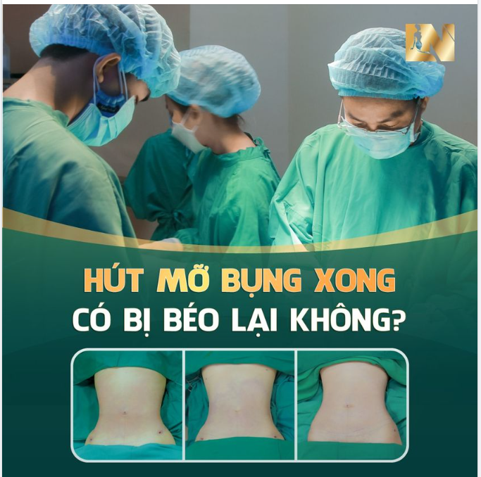 Sau hút mỡ, chỉ cần tuân thủ theo những hướng dẫn về cách chăm sóc, chế độ ăn uống phù hợp, không tăng cân nhiều sẽ giữ được vóc dáng thon gọn, đẹp như khi vừa mới thực hiện hút mỡ.
