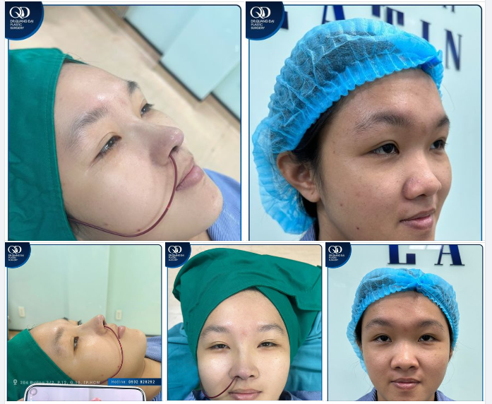 ĐÂY LÀ SỰ KHÁC BIỆT HOÀN TOÀN CHỈ SAU 2 TIẾNG