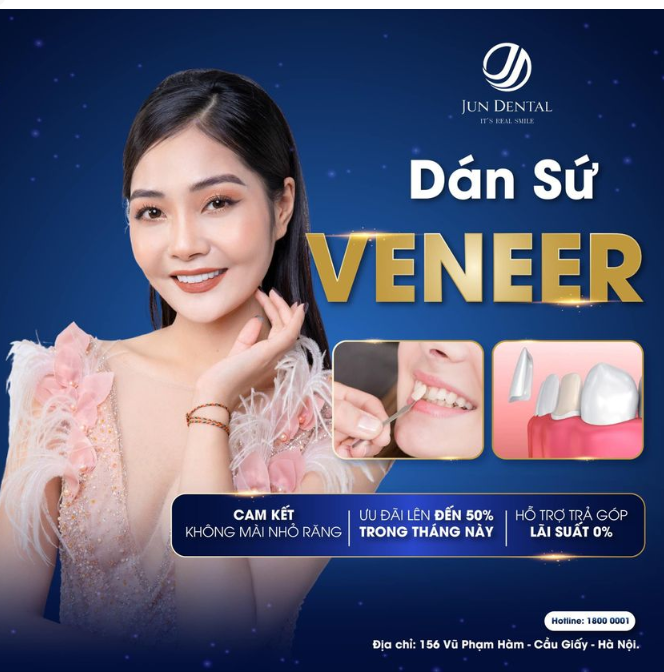 DÁN SỨ VENEER - KHÔNG GÂY TỔN THƯƠNG RĂNG THẬT