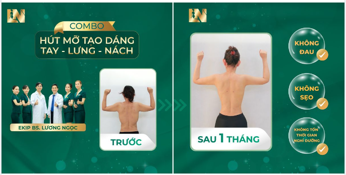 BODY ĐẸP TOÀN DIỆN - TRỞ VỀ VÓC DÁNG THANH XUÂN, TẠI SAO KHÔNG?