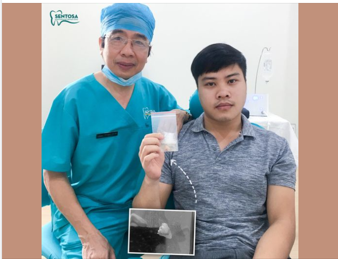 NHỔ RĂNG KHÔN KHÔNG KHÓ, CÁI KHÓ LÀ BẠN KHÔNG CHỊU NHỔ
