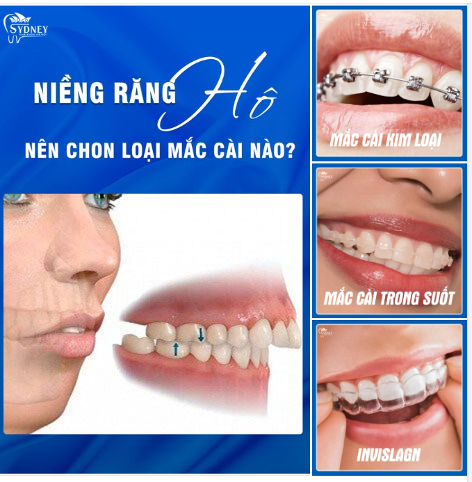 RĂNG HÔ NÊN LỰA CHỌN NIỀNG NÀO?