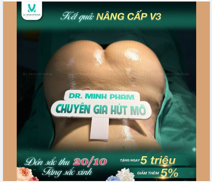 V3 nhỏ lép chưa bao giờ làm khó Dr Minh Phạm!