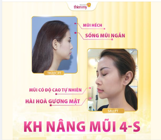 Trăm lời quảng cáo hay không bằng một feedback chân thật của khách hàng!
