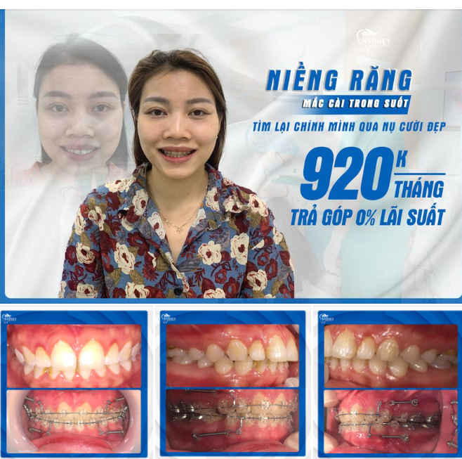 THAY ĐỔI BẢN THÂN NHỜ NỤ CƯỜI ĐẸP