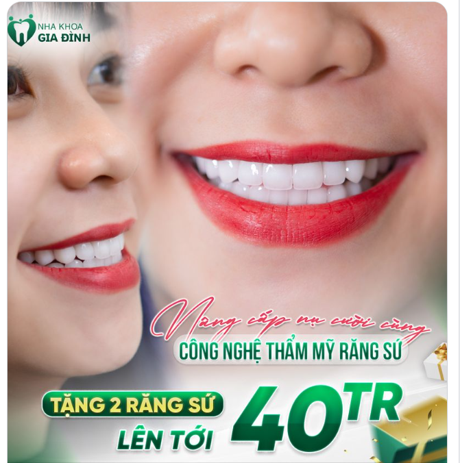 NÂNG CẤP NỤ CƯỜI CÙNG CÔNG NGHỆ THẨM MỸ RĂNG SỨ