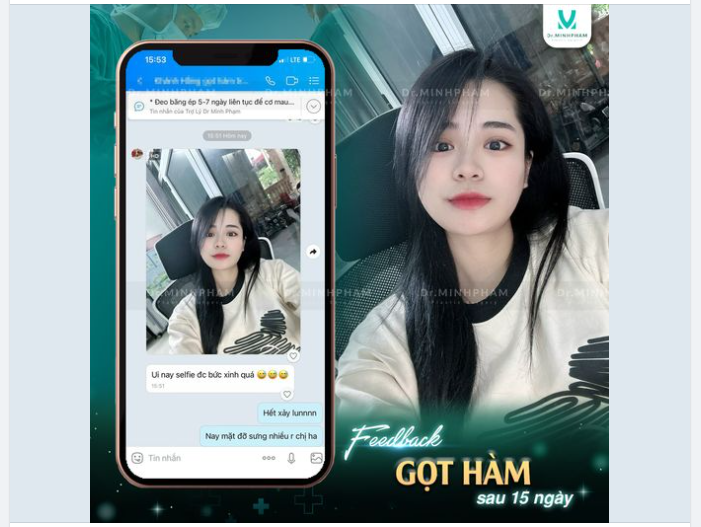 FEEDBACK GỌT HÀM CỰC NÉT SAU PT 15 NGÀY
