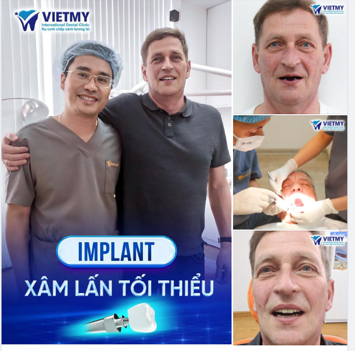 NGƯỜI NƯỚC NGOÀI TẠI VIỆT NAM CHỌN TRỒNG RĂNG Ở ĐÂU