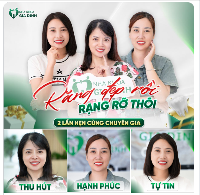 RĂNG ĐẸP RỒI - RẠNG RỠ THÔI