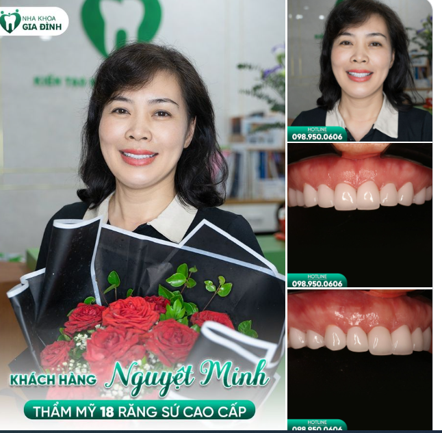 KHÔNG CHỜ ĐỢI THÊM NỮA, CHỊ KHÁCH CAO BẰNG QUYẾT ĐỊNH TÂN TRANG NỤ CƯỜI