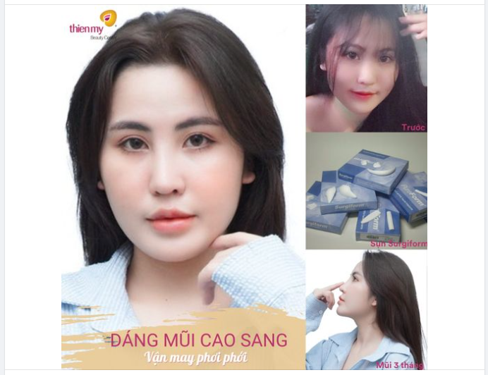 Hình ảnh feedback của K.H sau 3 tháng độ lại mũi tại Thiện Mỹ đây ạ