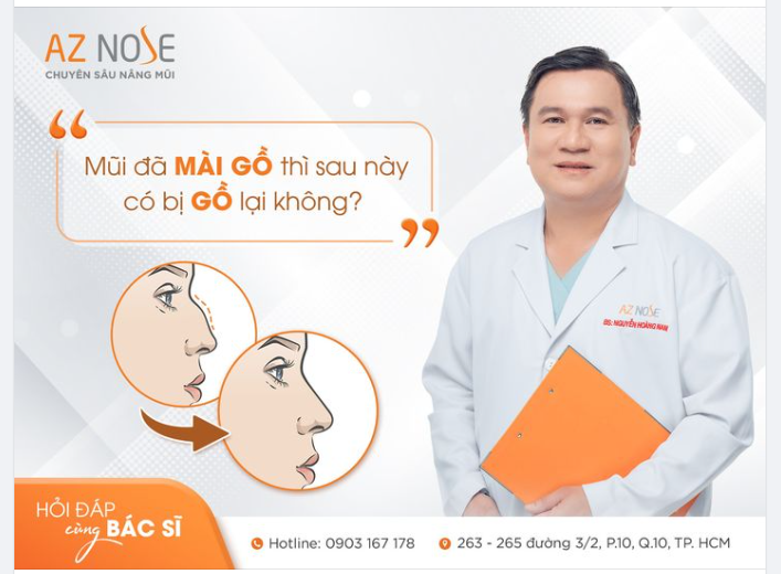 Mũi đã xử lý g.ồ thì sau này có bị trở lại không