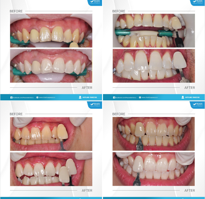HỆ THỐNG NHA KHOA PEACE DENTISTRY: