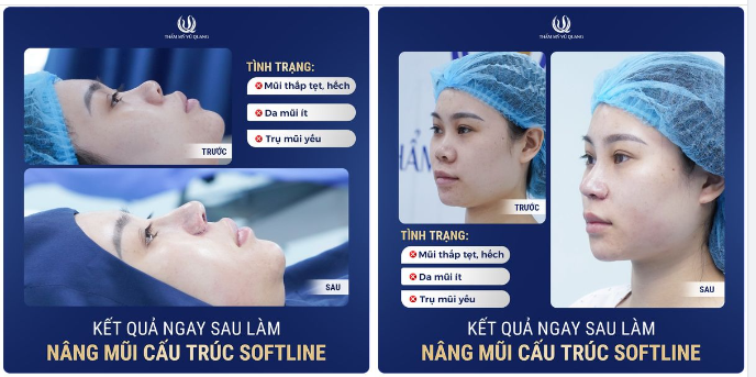 "Lỗ mũi mà hứng hạt mưa, phụ ấm để thừa tài sản cũng tiêu"