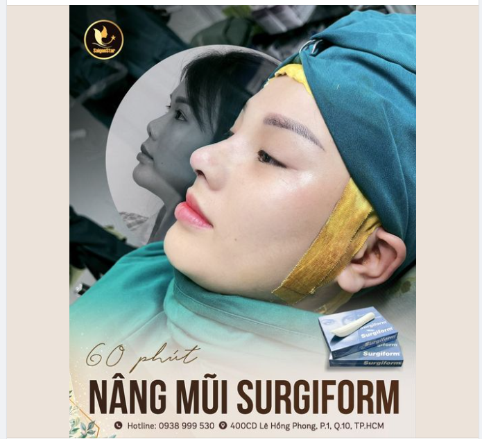 ĐẸP MỘT CÁCH QUÁ ĐÁNG 60 PHÚT NÂNG MŨI SURGIFORM