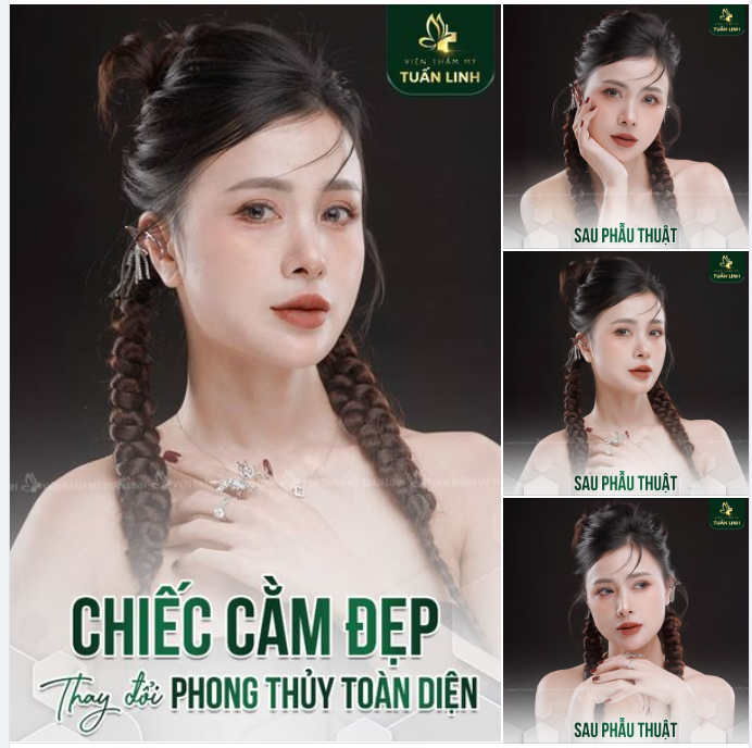 Một chiếc cằm đẹp, hợp phong thủy sẽ giúp khuôn mặt cân đối, hài hòa. xinh đẹp sắc nét hơn. Giúp bạn tự tin trong giao tiếp, gặt hái nhiều thành công và hạnh phúc hơn trong cuộc sống.
