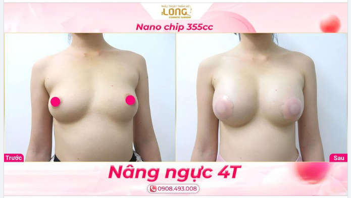 TĂNG SỰ CUỐN HÚT SAU 90 PHÚT TÁI SINH VÒNG 1