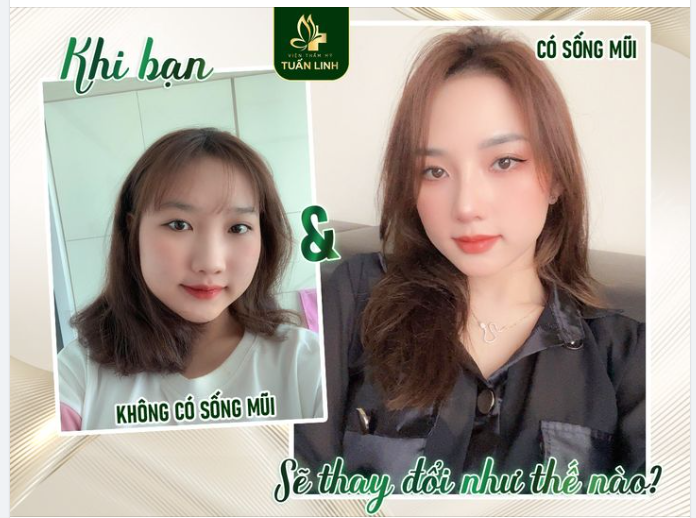 Một chiếc mũi cao đẹp sẽ giúp bạn xinh đẹp sắc nét hơn, các đường nét cân đối hài hòa và thanh tú hơn rất nhiều.