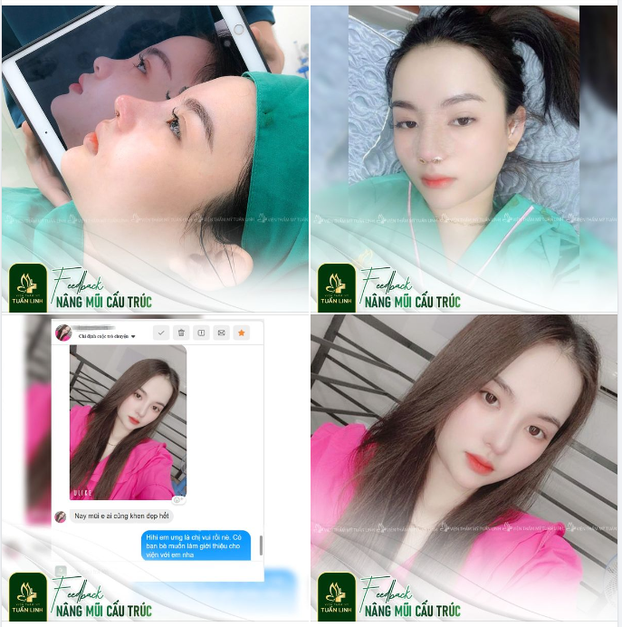 ​​​​​​​ Feedback chất lượng đến từ khách hàng nhà Tuấn Linh!!