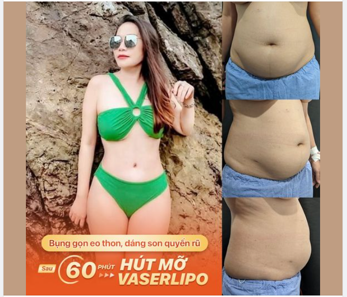 BỤNG GỌN EO THON, DÁNG SON QUYẾN RŨ