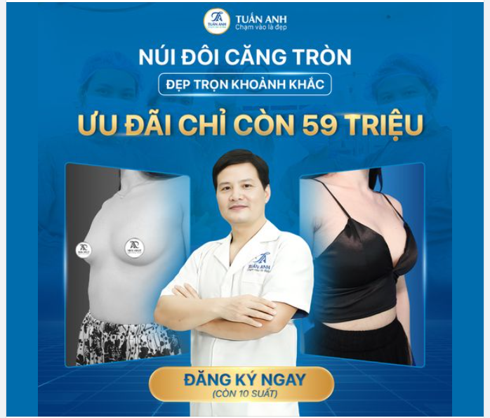 NÚI ĐÔI CĂNG TRÒN - ĐẸP TRỌN KHOẢNH KHẮC