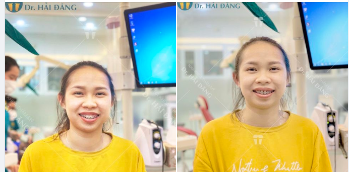 TẠM BIỆT NỤ CƯỜI KÉM DUYÊN