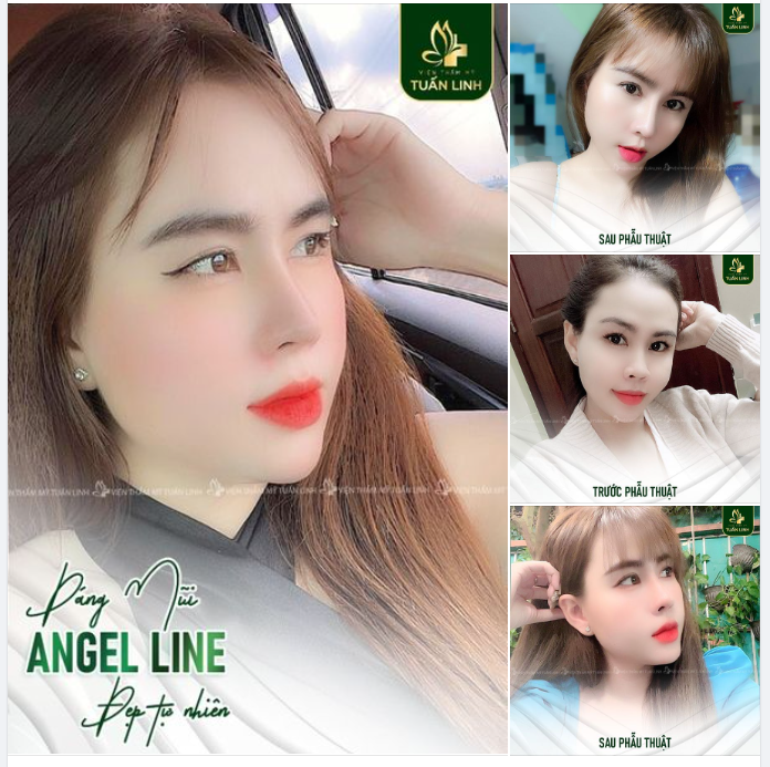 TRONG VÔ VÀN CÁCH ĐỂ YÊU THƯƠNG BẢN THÂN - BẠN CHỌN CÁCH NÀO
