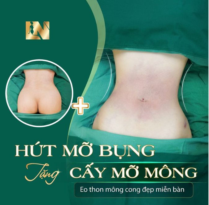 HÚT MỠ TẠO DÁNG - CẤY MỠ TỰ THÂN - CHẠM ĐẾN DÁNG VÓC HOÀN MỸ