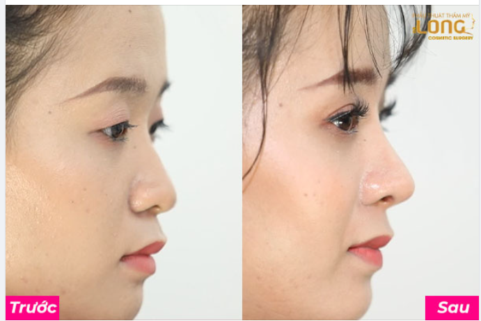 ĐÂY LÀ LÝ DO KHIẾN CÁC CHỊ EM NGÀY NAY “ĐẸP” NHANH CHÓNG.