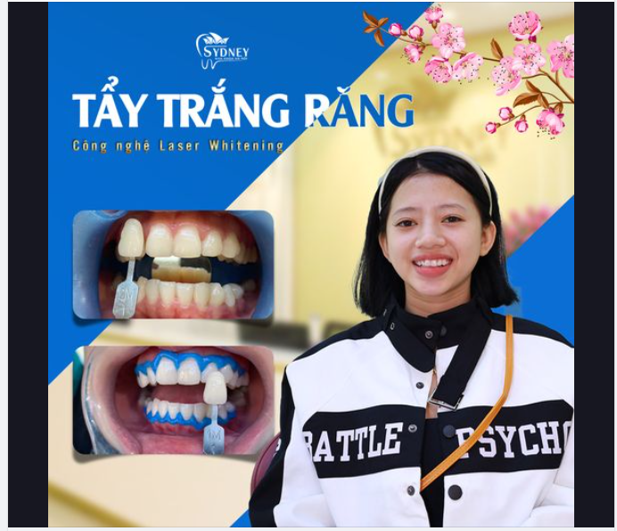 TẨY TRẮNG RĂNG - BẬT TÔNG NGAY LẦN ĐẦU TẨY