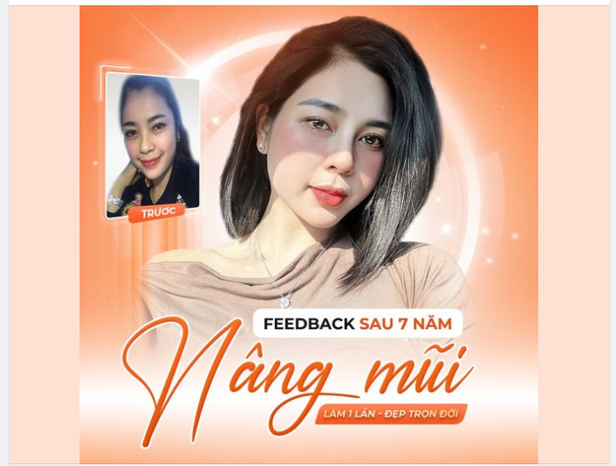 "Thành quả" ngọt ngào sau 6 năm Nâng mũi