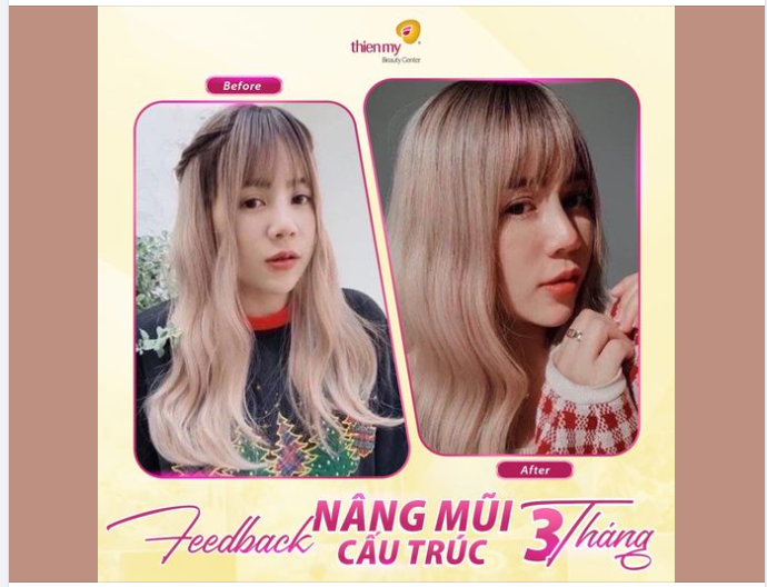 MŨI CAO THON – VẬN MAY TỚI TẤP