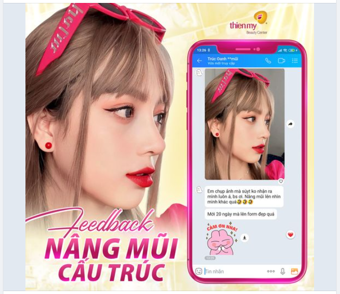 Xinh như hot girl sau khi nâng mũi tại Thiện Mỹ