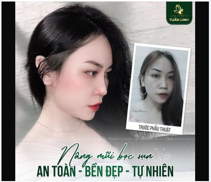 Cơ hội thăng hạng nhan sắc chỉ với 15 triệu đồng