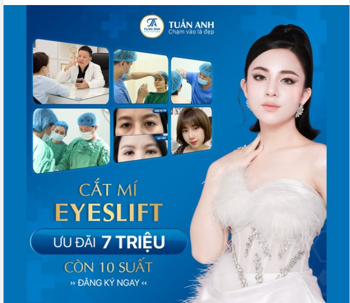 Sở hữu ngay đôi mắt 2 mí "cực phẩm" như hàng ngàn khách hàng tân trang nhan sắc thành công tại Thẩm mỹ Tuấn Anh