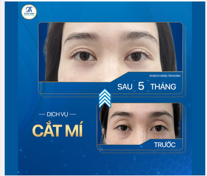 CĂT MÍ XONG MẮT ĐẸP THẾ NÀY, BẢO SAO CHỊ EM NÀO CŨNG MÊ