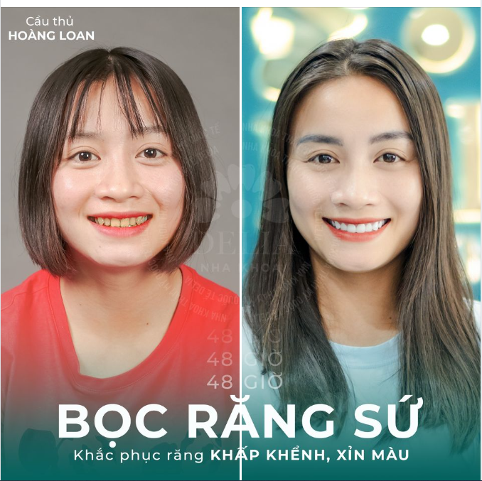 CẦU THỦ HOÀNG LAN ĐẾN VỚI DELIA