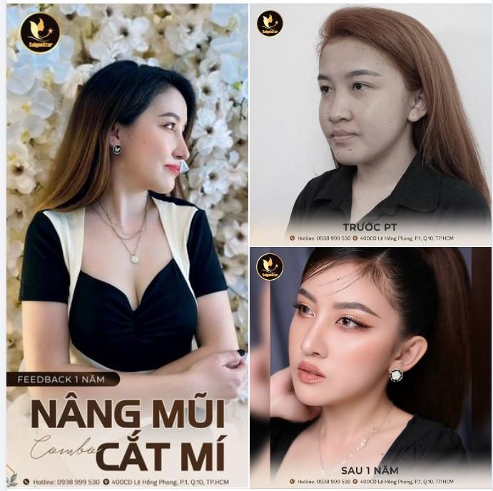 Khoản đầu tư sinh lời nhất chính là khoản đầu tư để nâng cấp bản thân mình