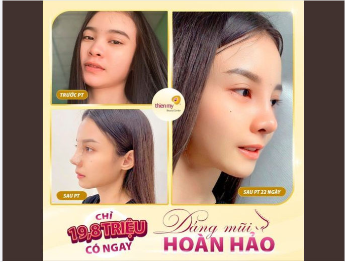 Công nhận đổi dáng mũi xong, nhan sắc thăng hạng vượt bậc các nàng ạ!